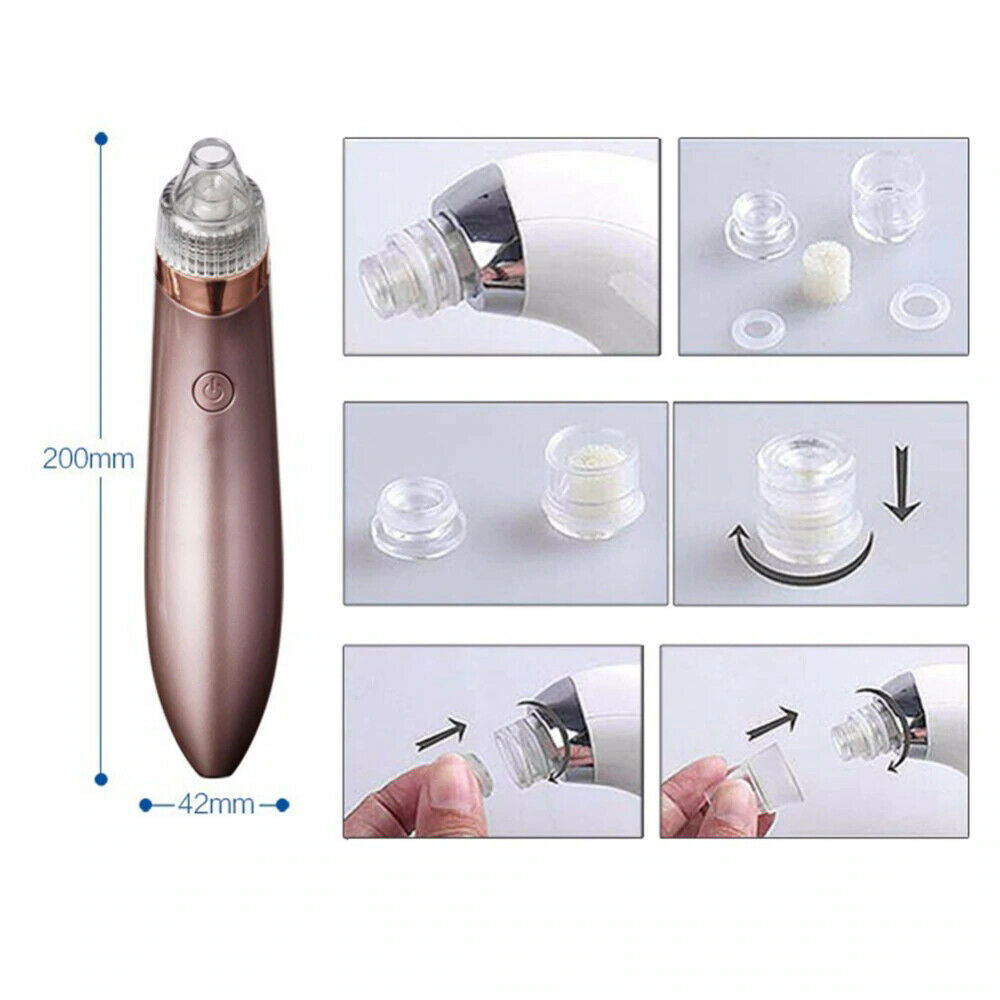 Electric Blackhead Remover – Deep Pore Vacuum Cleaner with 4 Heads & USB Recharge