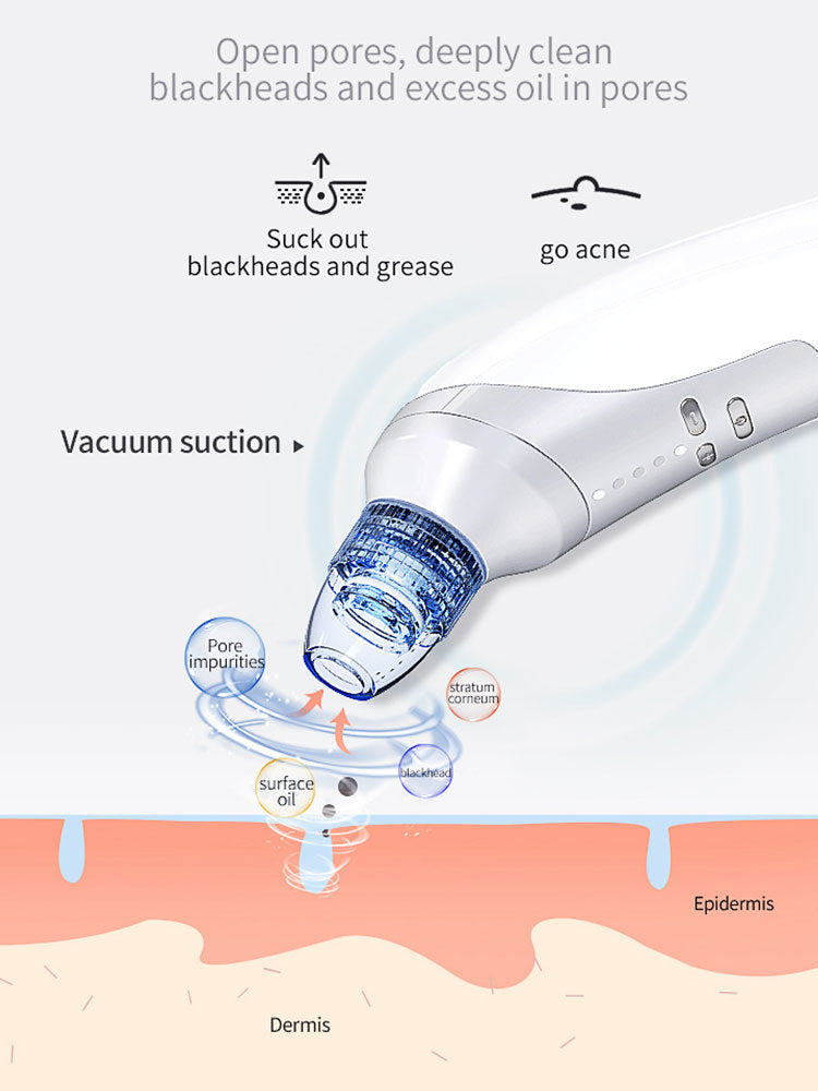 Electric Blackhead Remover with 4 Suction Heads – Rechargeable Pore Cleaner