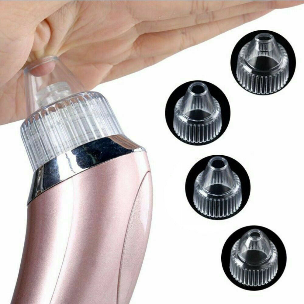 Electric Blackhead Remover – Deep Pore Vacuum Cleaner with 4 Heads & USB Recharge